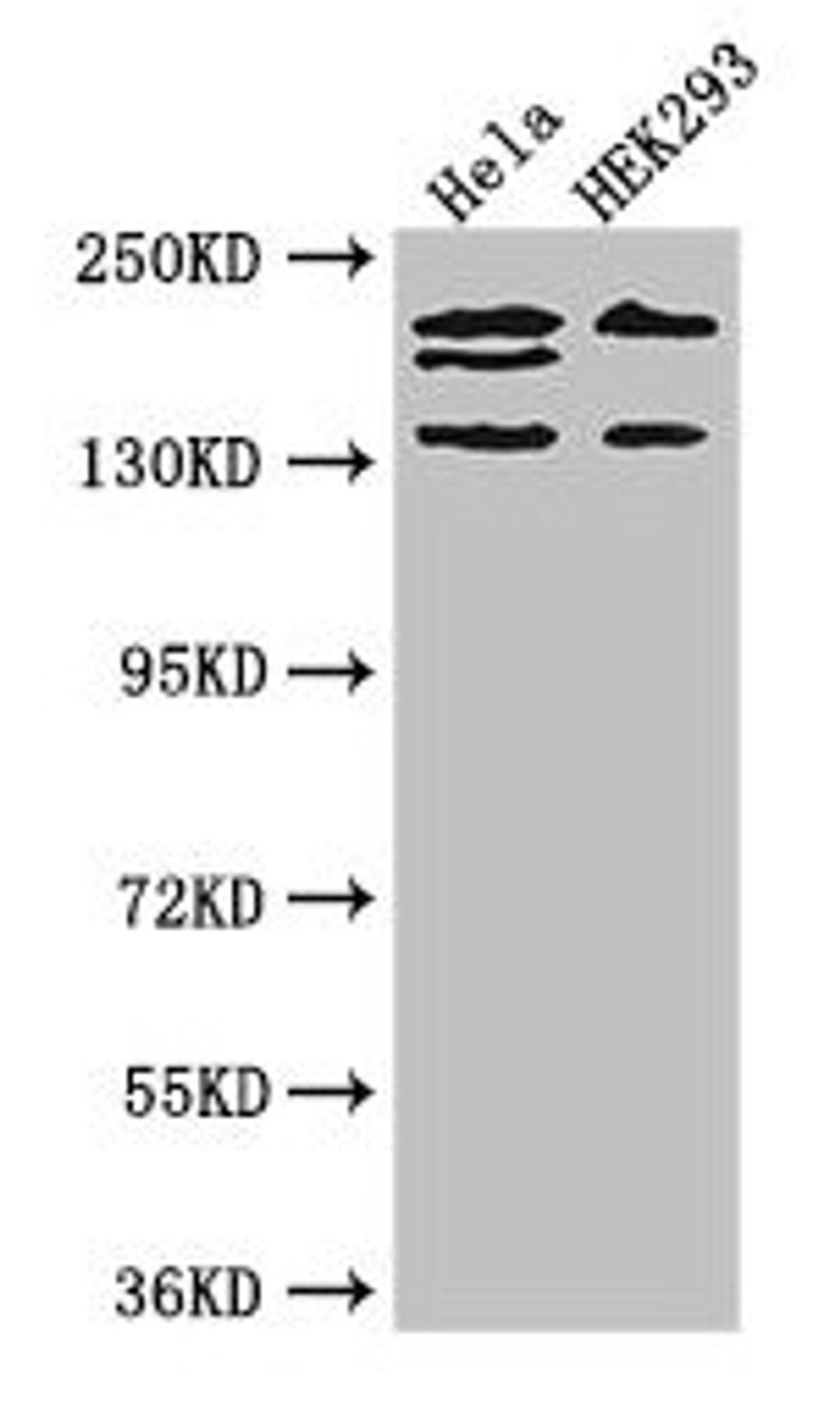 Western Blot. Positive WB detected in: Hela whole cell lysate, HEK293 whole cell lysate. All lanes: ITSN2 antibody at 4µg/ml. Secondary. Goat polyclonal to rabbit IgG at 1/50000 dilution. Predicted band size: 194, 191, 142, 136 kDa. Observed band size: 194, 191, 142 kDa