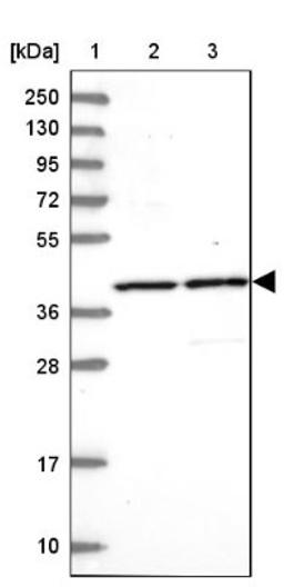 Western Blot: C3orf37 Antibody [NBP2-14410] - Lane 1: Marker [kDa] 250, 130, 95, 72, 55, 36, 28, 17, 10<br/>Lane 2: Human cell line RT-4<br/>Lane 3: Human cell line U-251MG sp