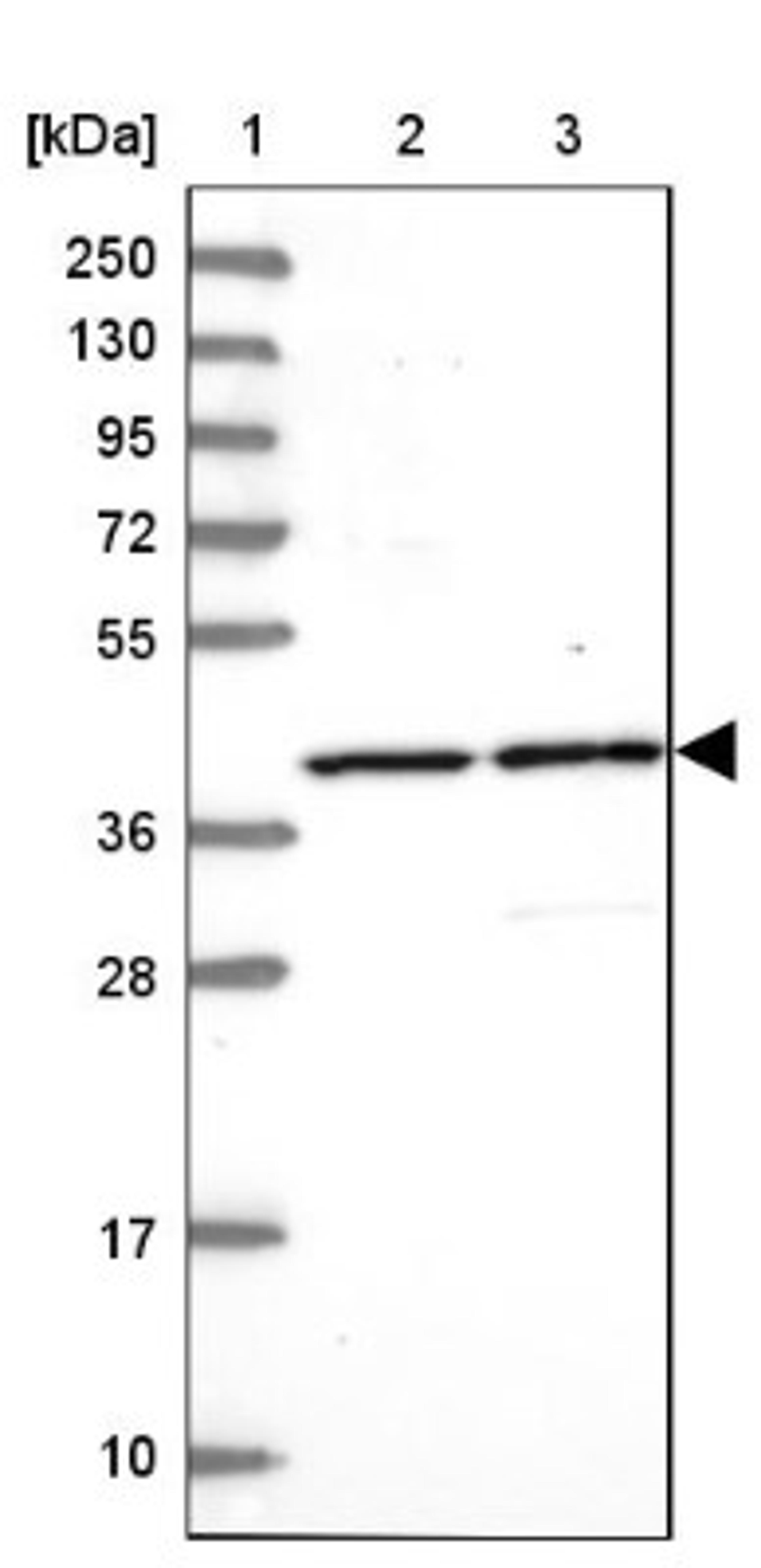 Western Blot: C3orf37 Antibody [NBP2-14410] - Lane 1: Marker [kDa] 250, 130, 95, 72, 55, 36, 28, 17, 10<br/>Lane 2: Human cell line RT-4<br/>Lane 3: Human cell line U-251MG sp