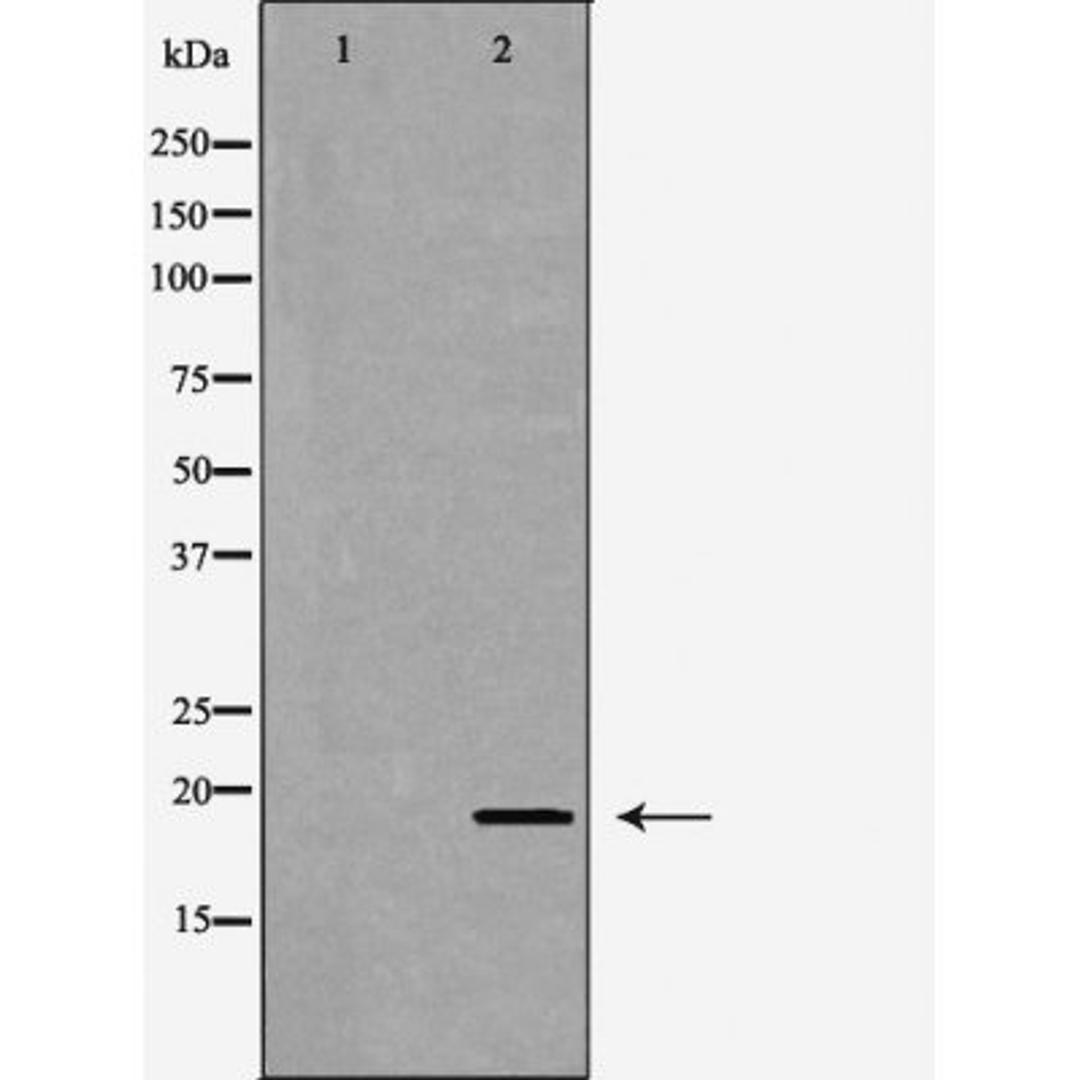 Western blot analysis of K562 cell and A549 cell lysate using C19orf10 antibody