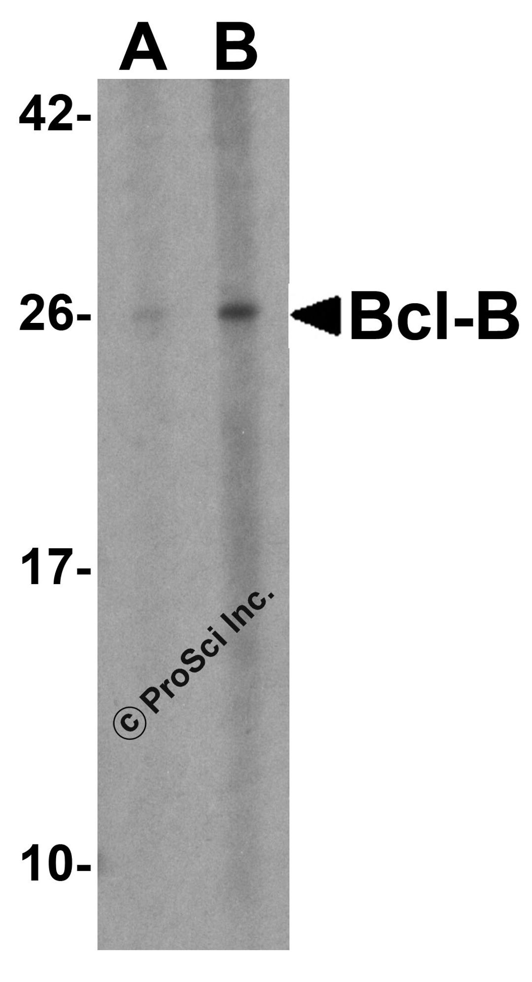 Western blot analysis of Bcl-B in Jurkat cell lysate with Bcl-B antibody at (A) 1 and (B) 2 μg/mL.