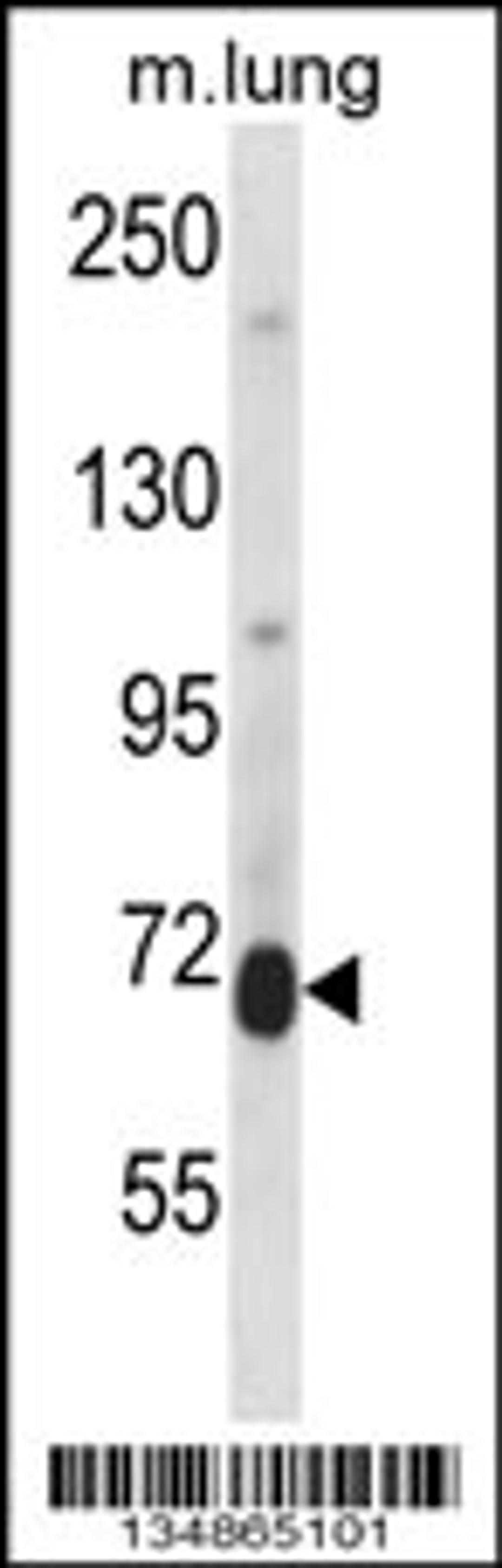 Western blot analysis in mouse lung tissue lysates (35ug/lane).