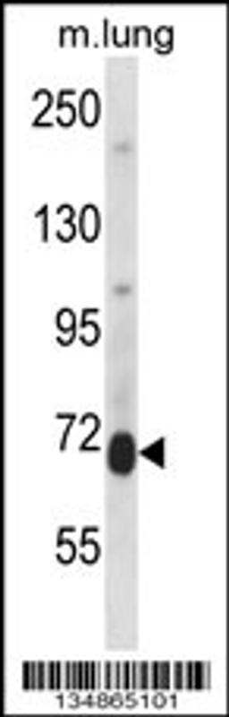 Western blot analysis in mouse lung tissue lysates (35ug/lane).