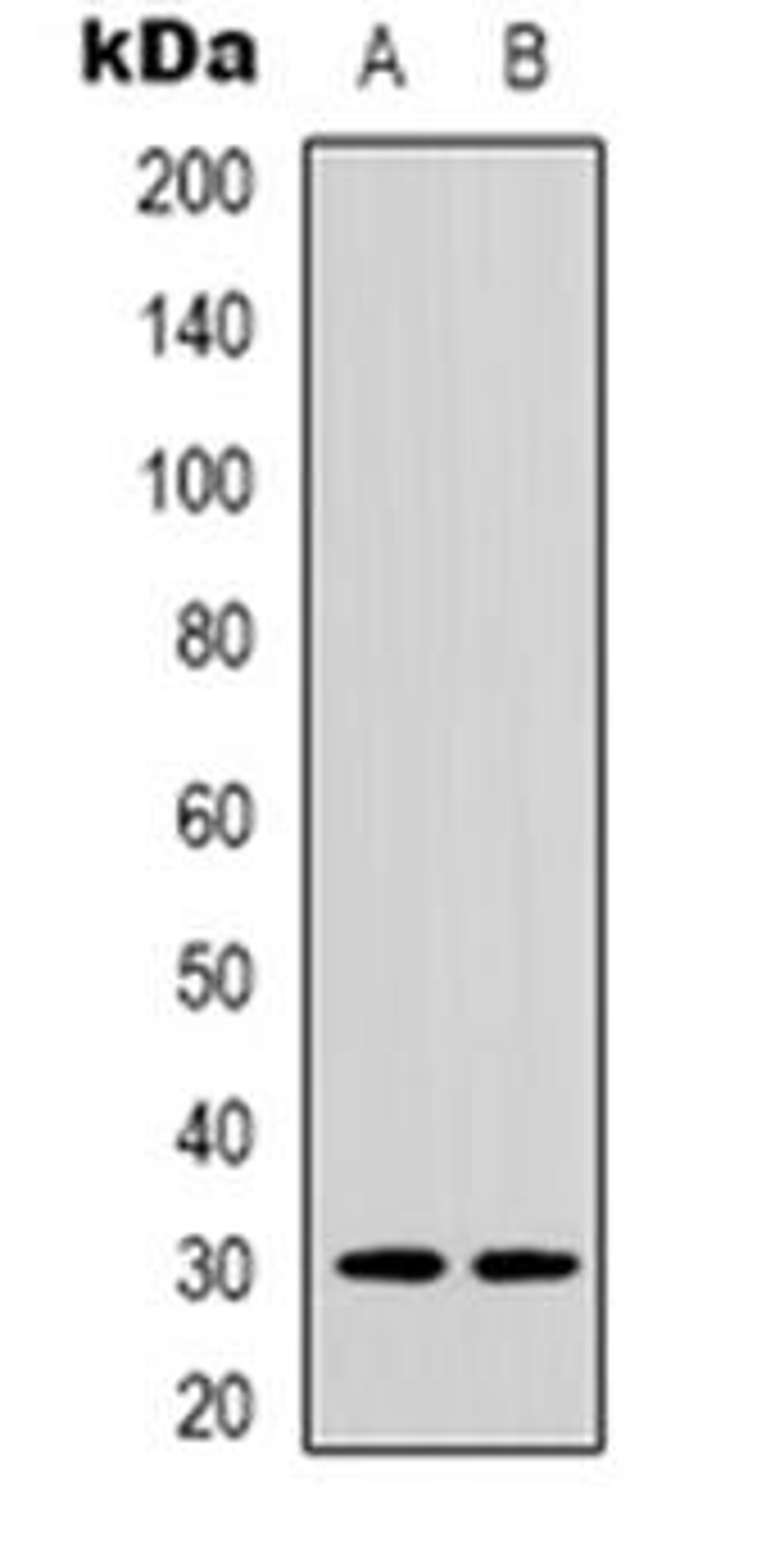 Western blot analysis of ACBD6 expression in HepG2 (Lane 1), U251 (Lane 2) whole cell lysates using ACBD6 antibody