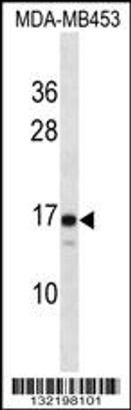 Western blot analysis in MDA-MB453 cell line lysates (35ug/lane).