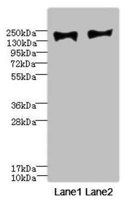 Western blot. All lanes: MRC2 antibody at 3.84ug/ml. Lane 1: HepG2 whole cell lysate. Lane 2: A549 whole cell lysate. Secondary. Goat polyclonal to rabbit IgG at 1/10000 dilution. Predicted band size: 167 kDa. Observed band size: 167 kDa.