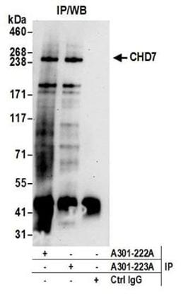 Detection of human CHD7 by western blot of immunoprecipitates.