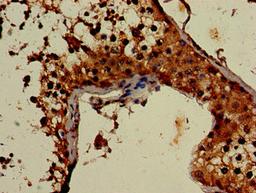 Immunohistochemistry of paraffin-embedded human testis tissue using CSB-PA836199LA01HU at dilution of 1:100