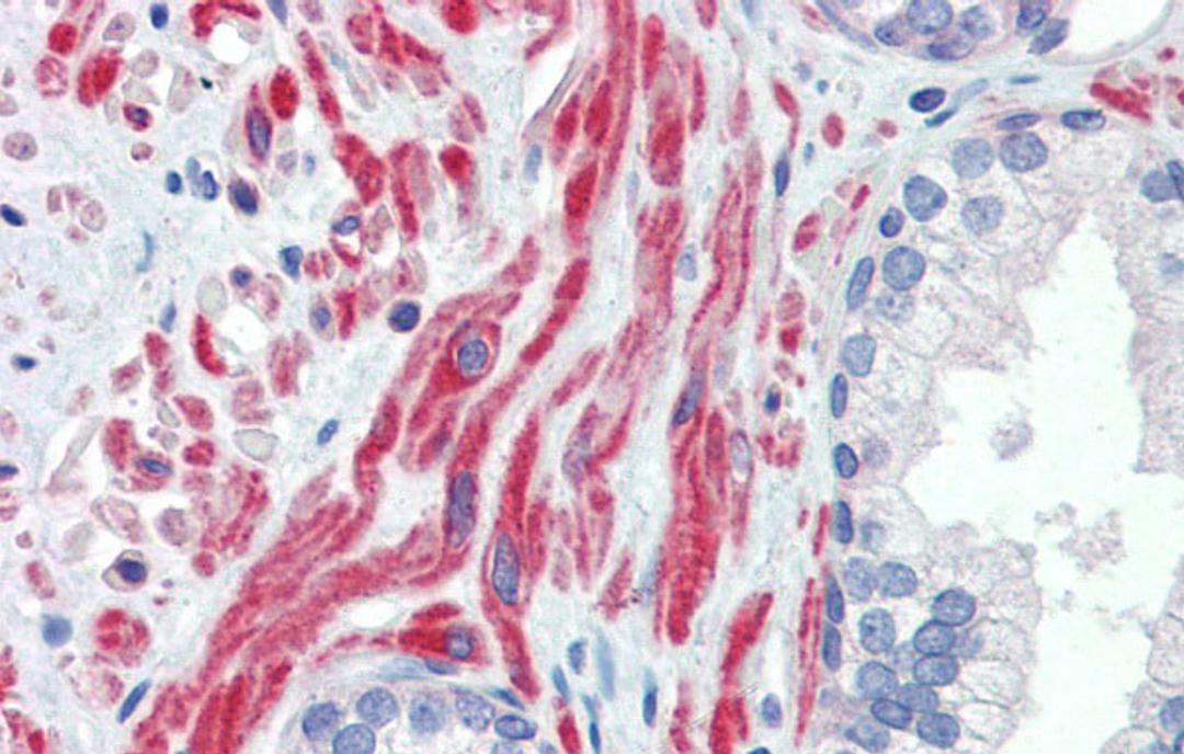 Antibody used in IHC on Human Prostate at 5.0 ug/ml.