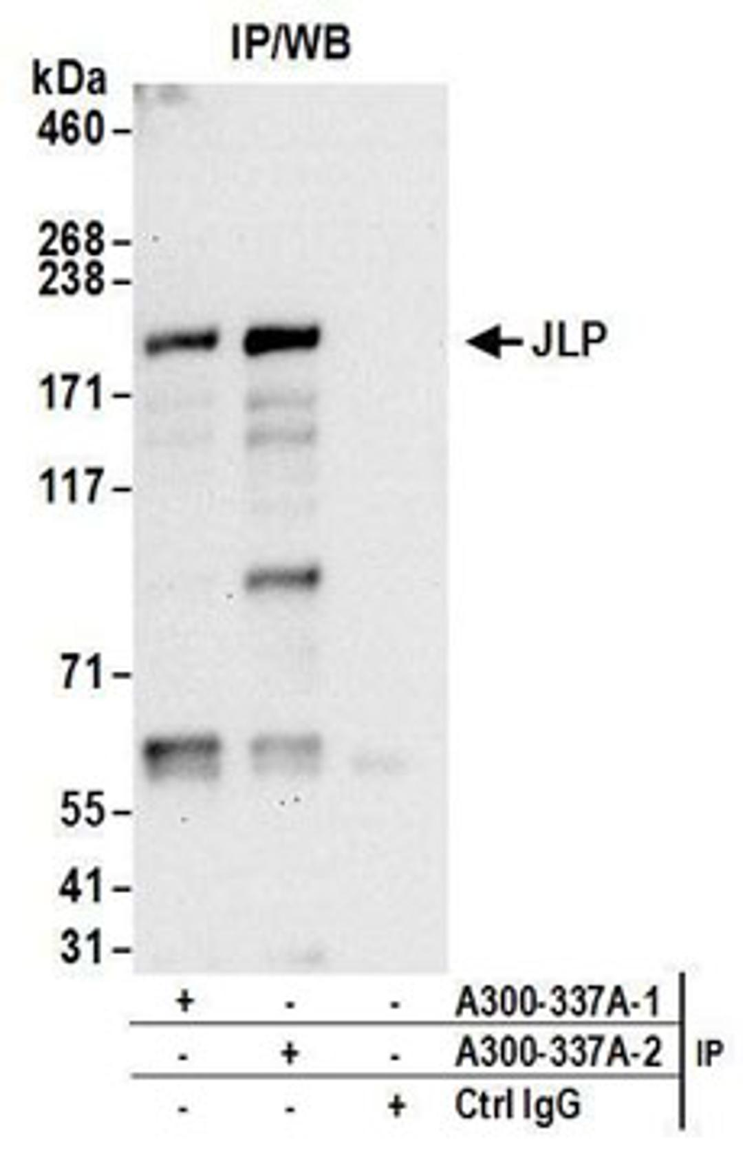 Detection of human JLP by western blot of immunoprecipitates.