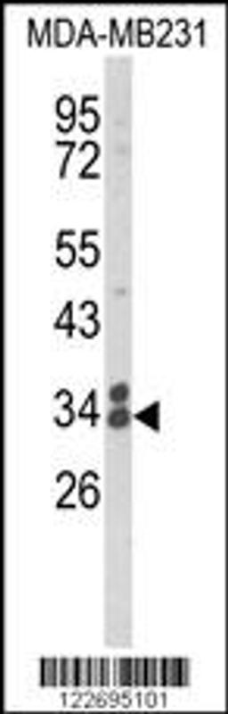 Western blot analysis of CLTA Antibody in MDA-MB231 cell line lysates (35ug/lane)