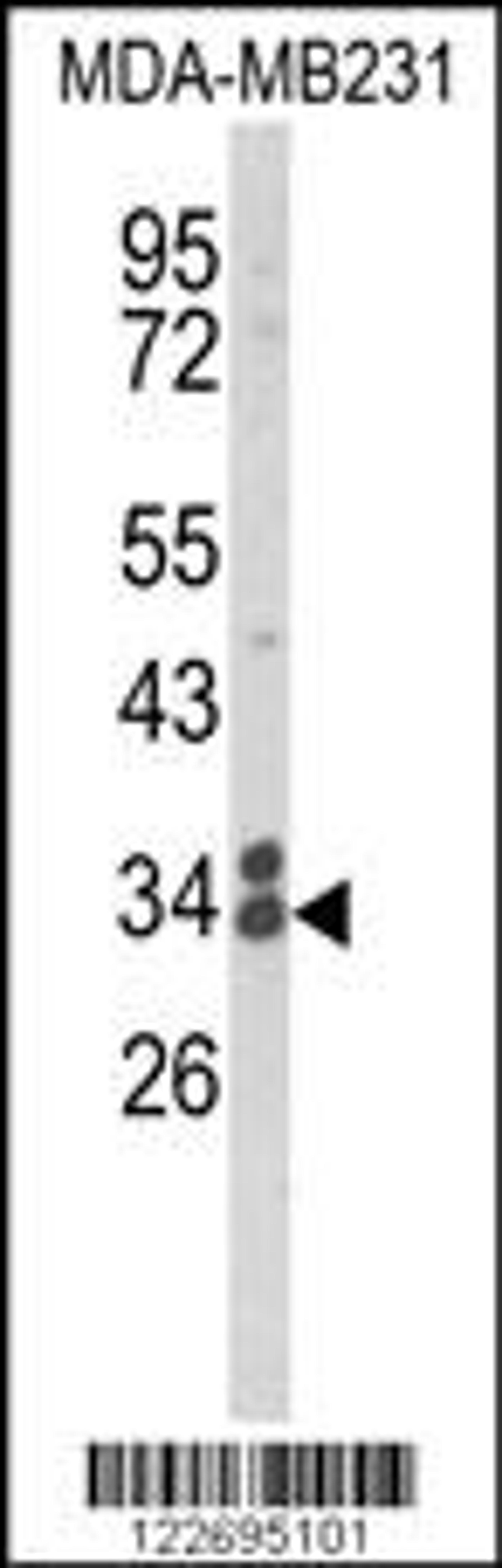 Western blot analysis of CLTA Antibody in MDA-MB231 cell line lysates (35ug/lane)