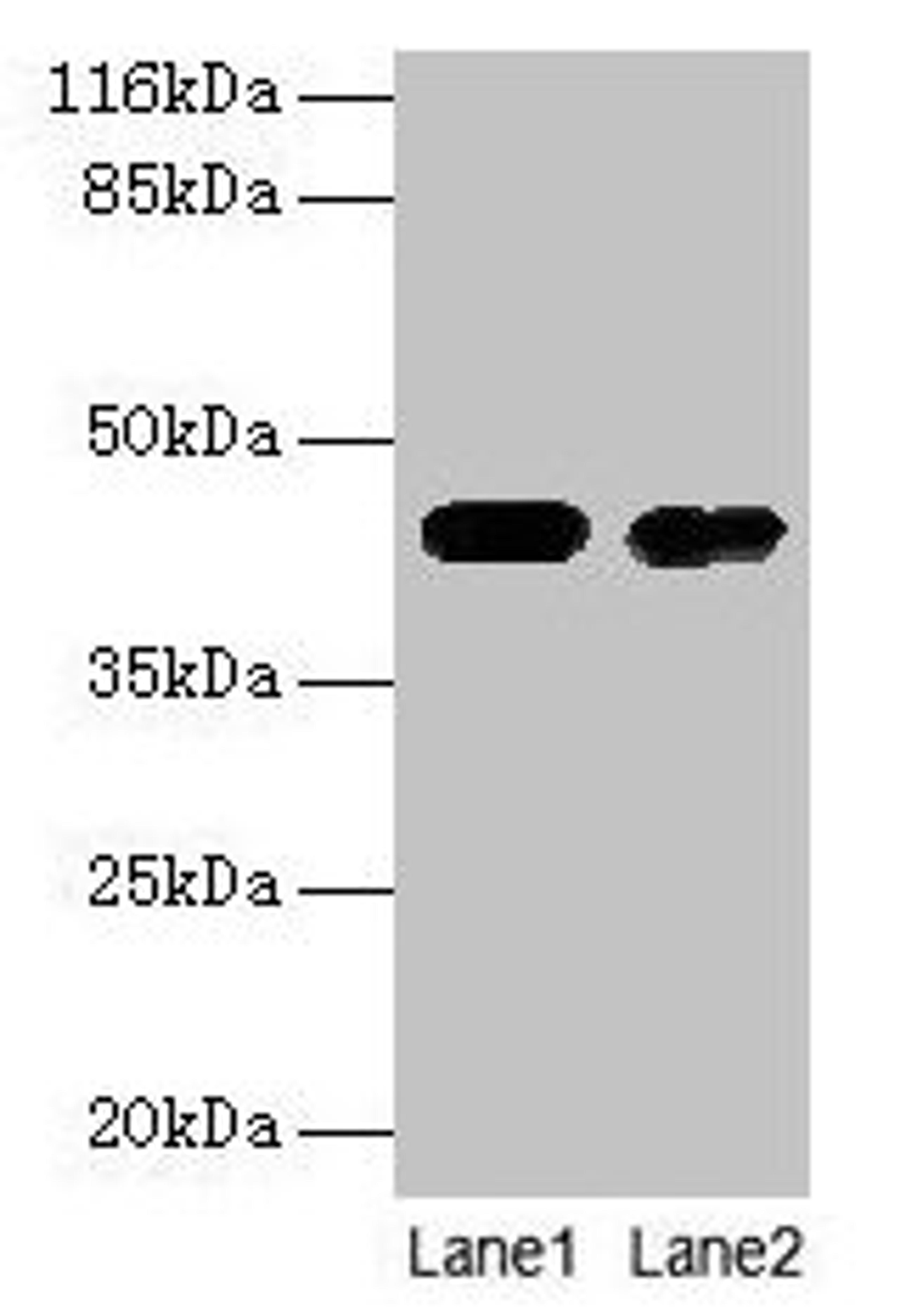Western blot. All lanes: CKB antibody at 2µg/ml. Lane 1: Mouse brain tissue. Lane 2: 293T whole cell lysate. Secondary. Goat polyclonal to rabbit IgG at 1/10000 dilution. Predicted band size: 43 kDa. Observed band size: 43 kDa