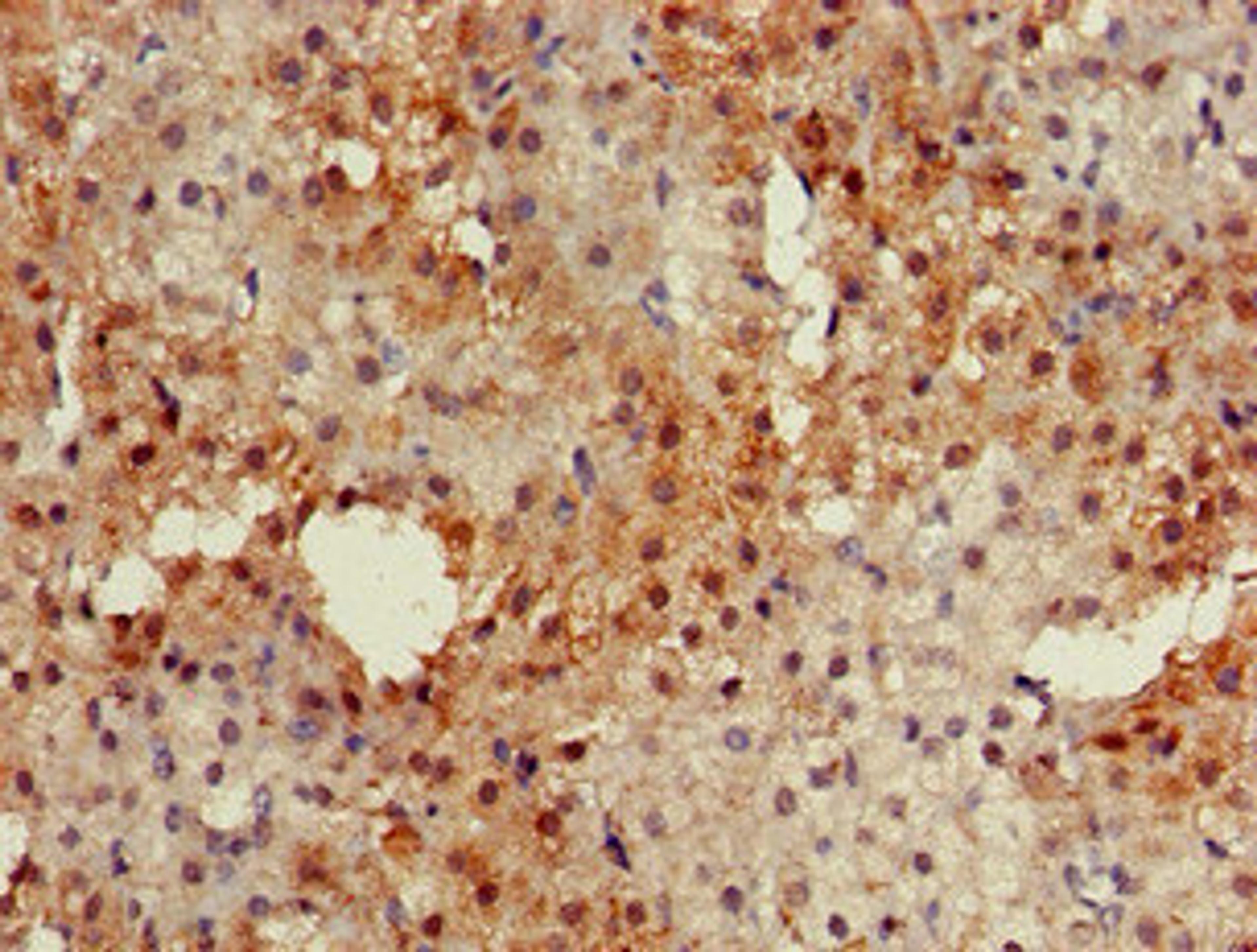 Immunohistochemistry of paraffin-embedded human adrenal gland tissue using CSB-PA883651LA01HU at dilution of 1:100