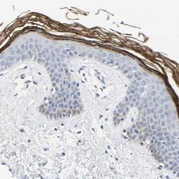 Immunohistochemistry: Kallikrein 5 Antibody [NBP1-89588] - Immunohistochemical staining of human skin shows distinct positivity in the kertinized layer.