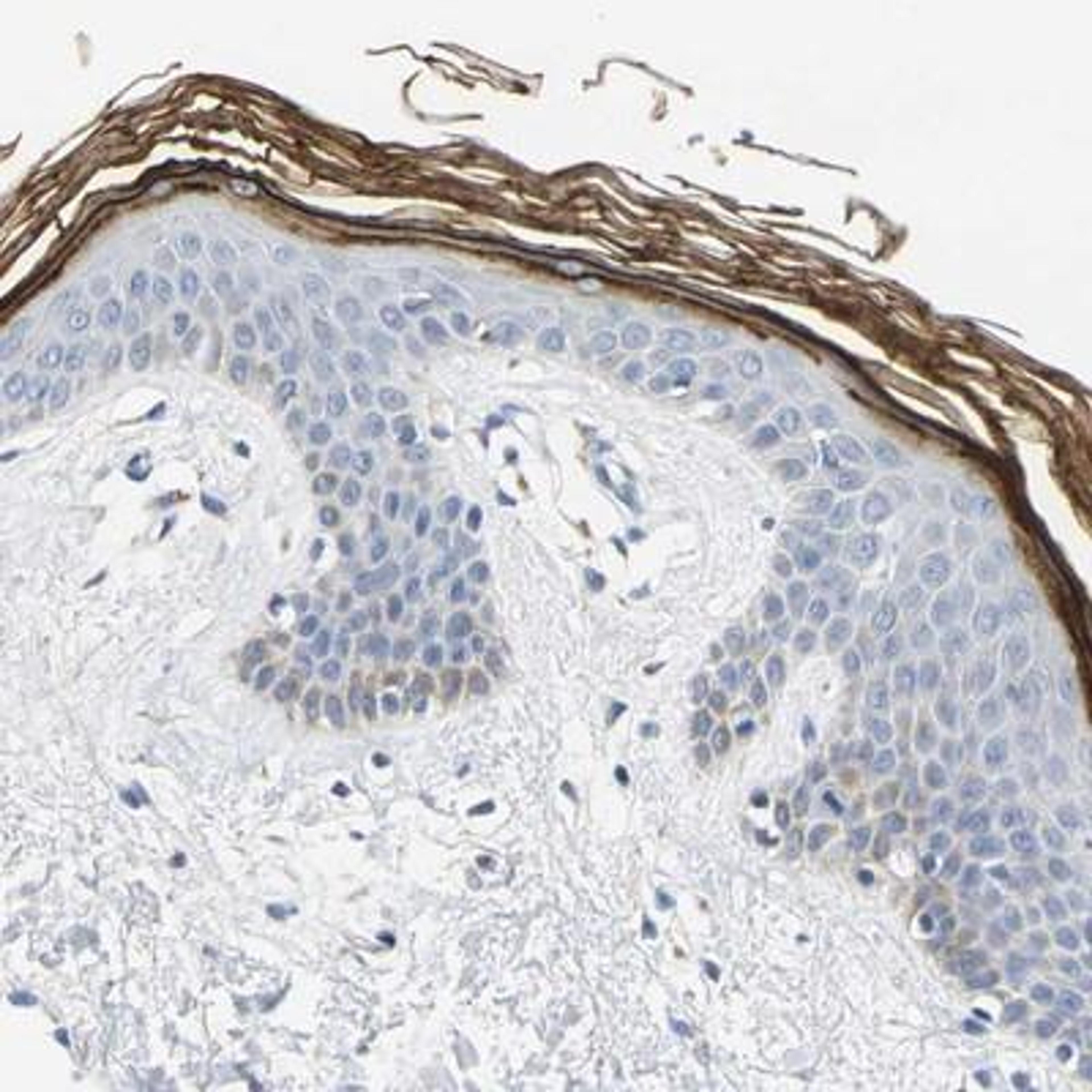 Immunohistochemistry: Kallikrein 5 Antibody [NBP1-89588] - Immunohistochemical staining of human skin shows distinct positivity in the kertinized layer.