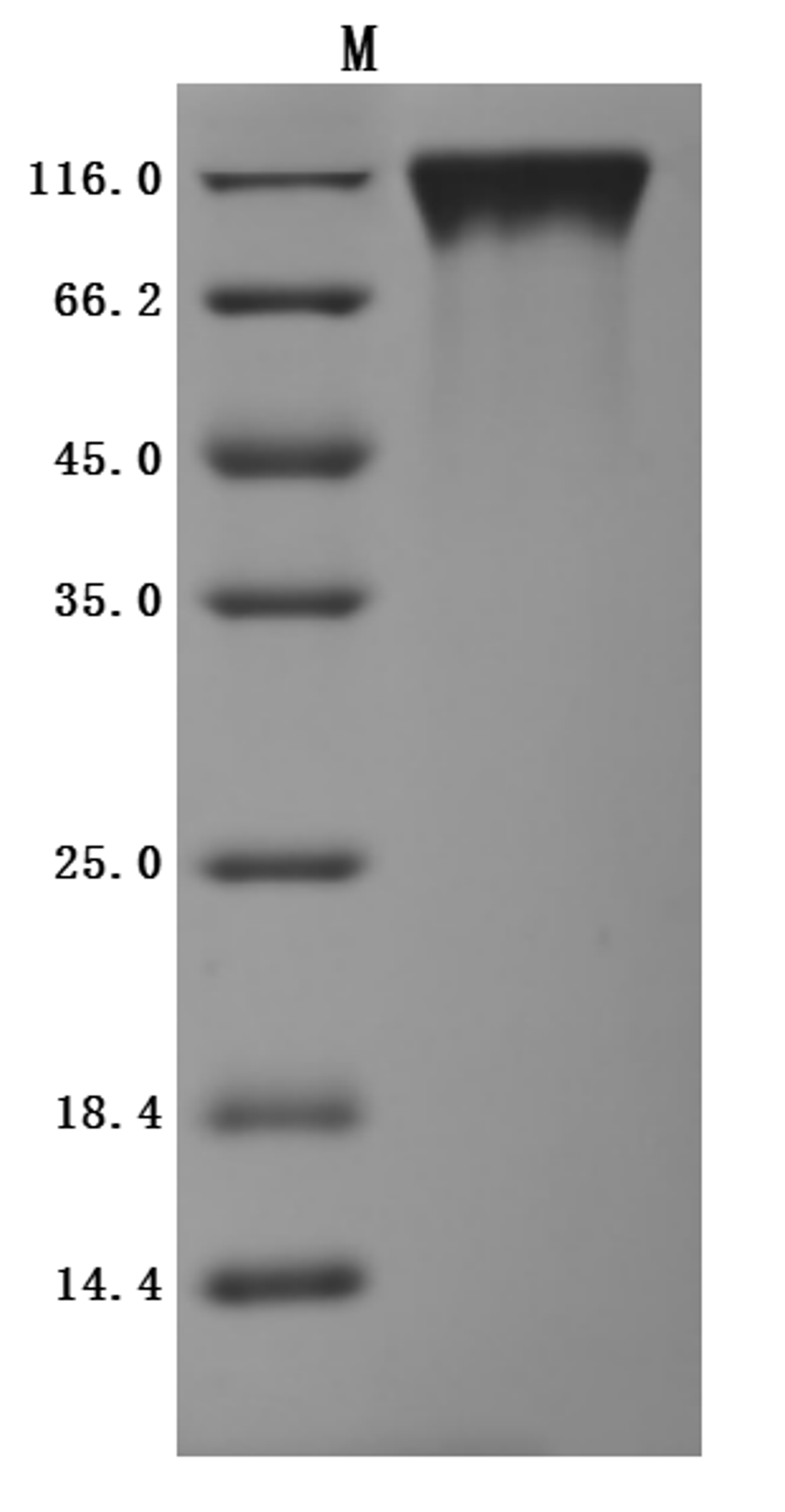 (Tris-Glycine gel) Discontinuous SDS-PAGE (reduced) with 5% enrichment gel and 15% separation gel.