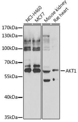 Western blot - AKT1 antibody (A7270)