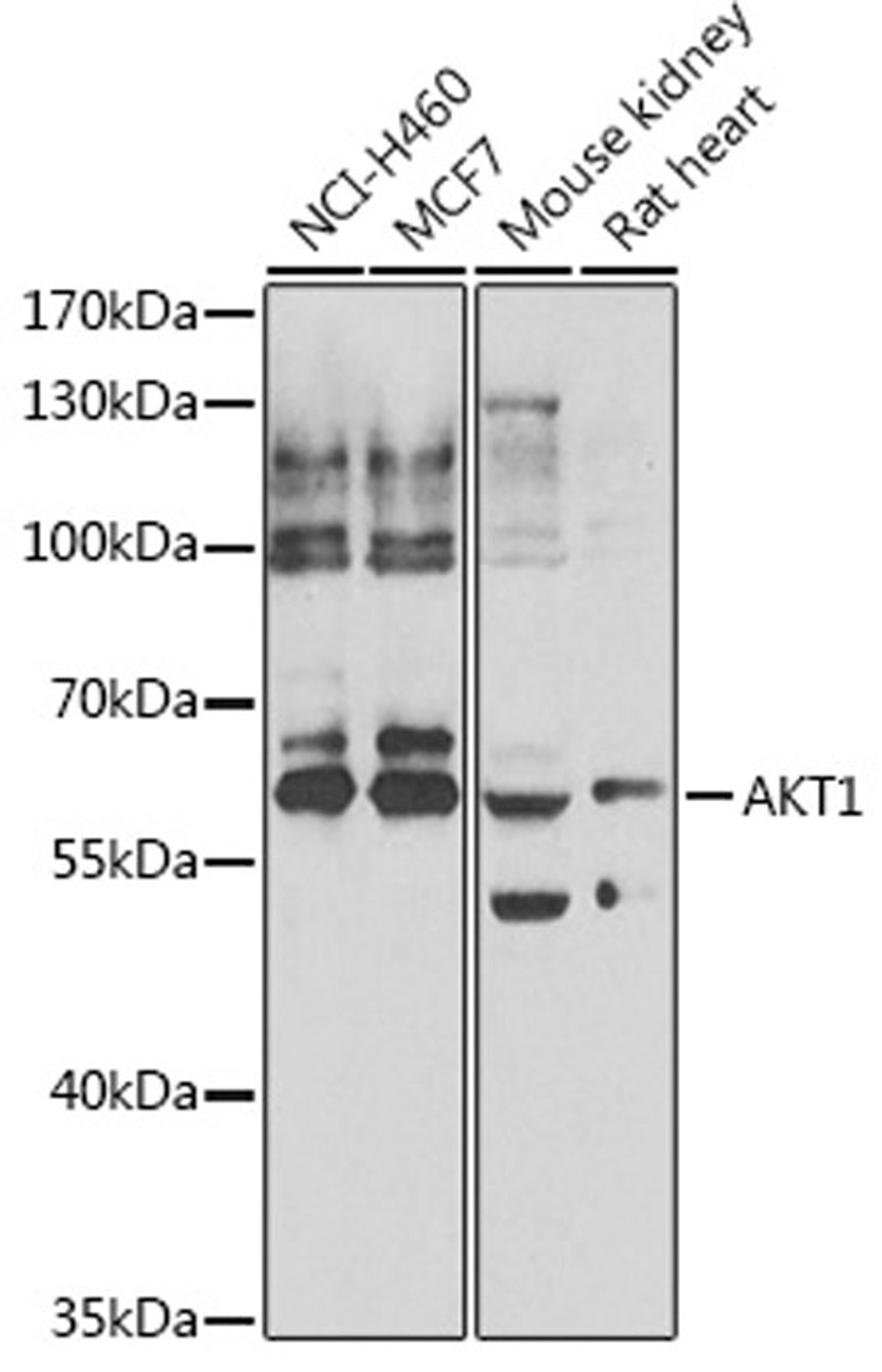 Western blot - AKT1 antibody (A7270)