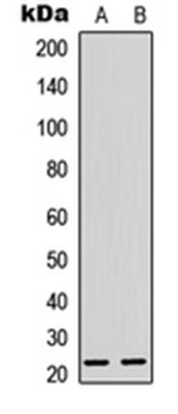 Western blot analysis of K562 (Lane 1), mouse brain (Lane 2) whole cell lysates using Musculin antibody