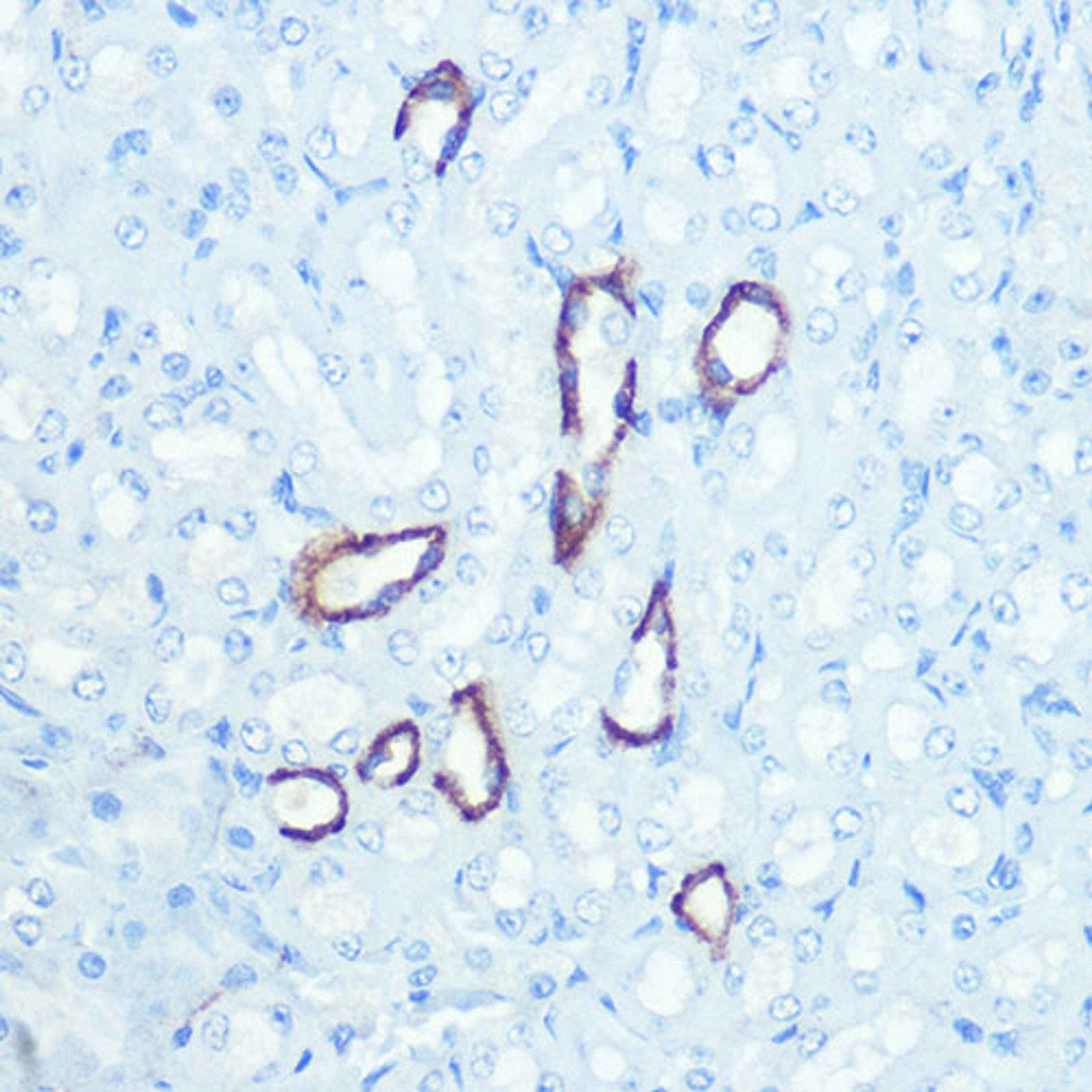 Immunohistochemistry  - AQP4 Rabbit mAb (A11210)