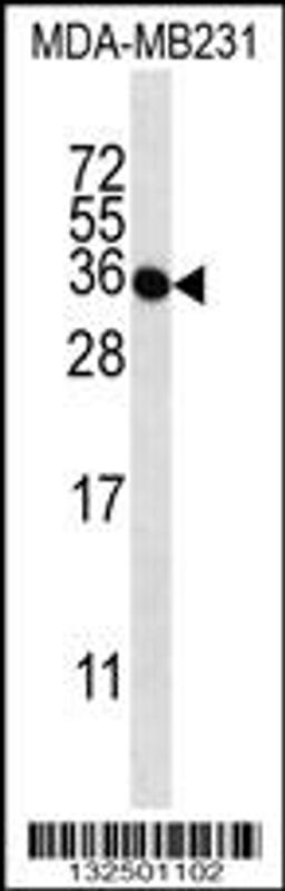 Western blot analysis in MDA-MB231 cell line lysates (35ug/lane).