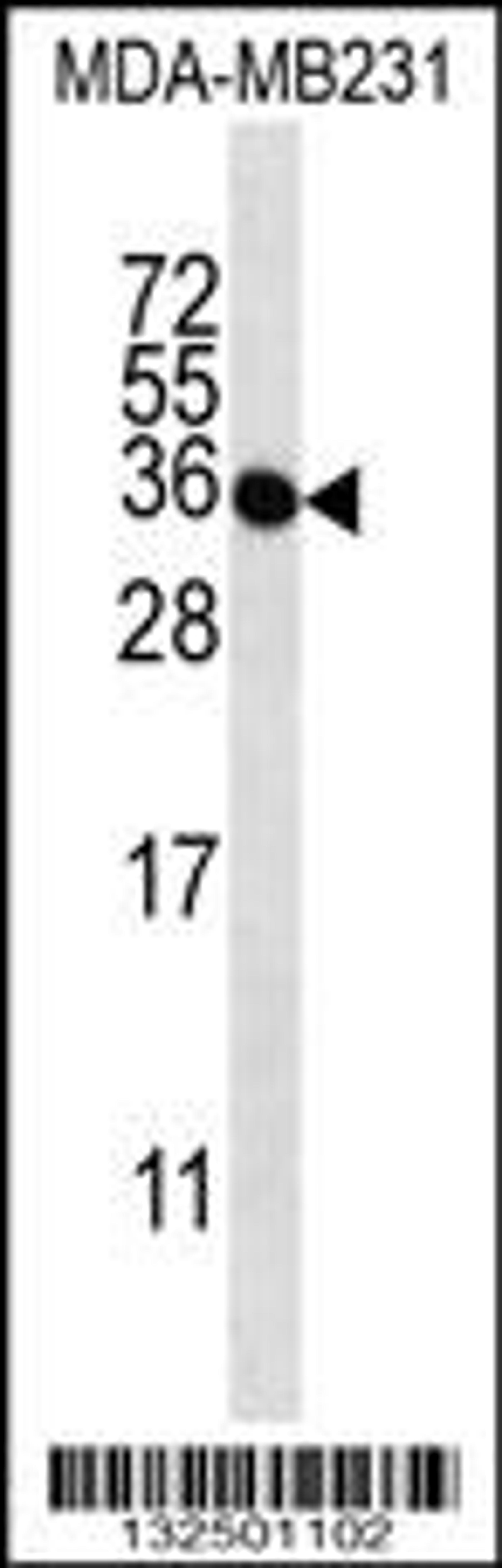 Western blot analysis in MDA-MB231 cell line lysates (35ug/lane).