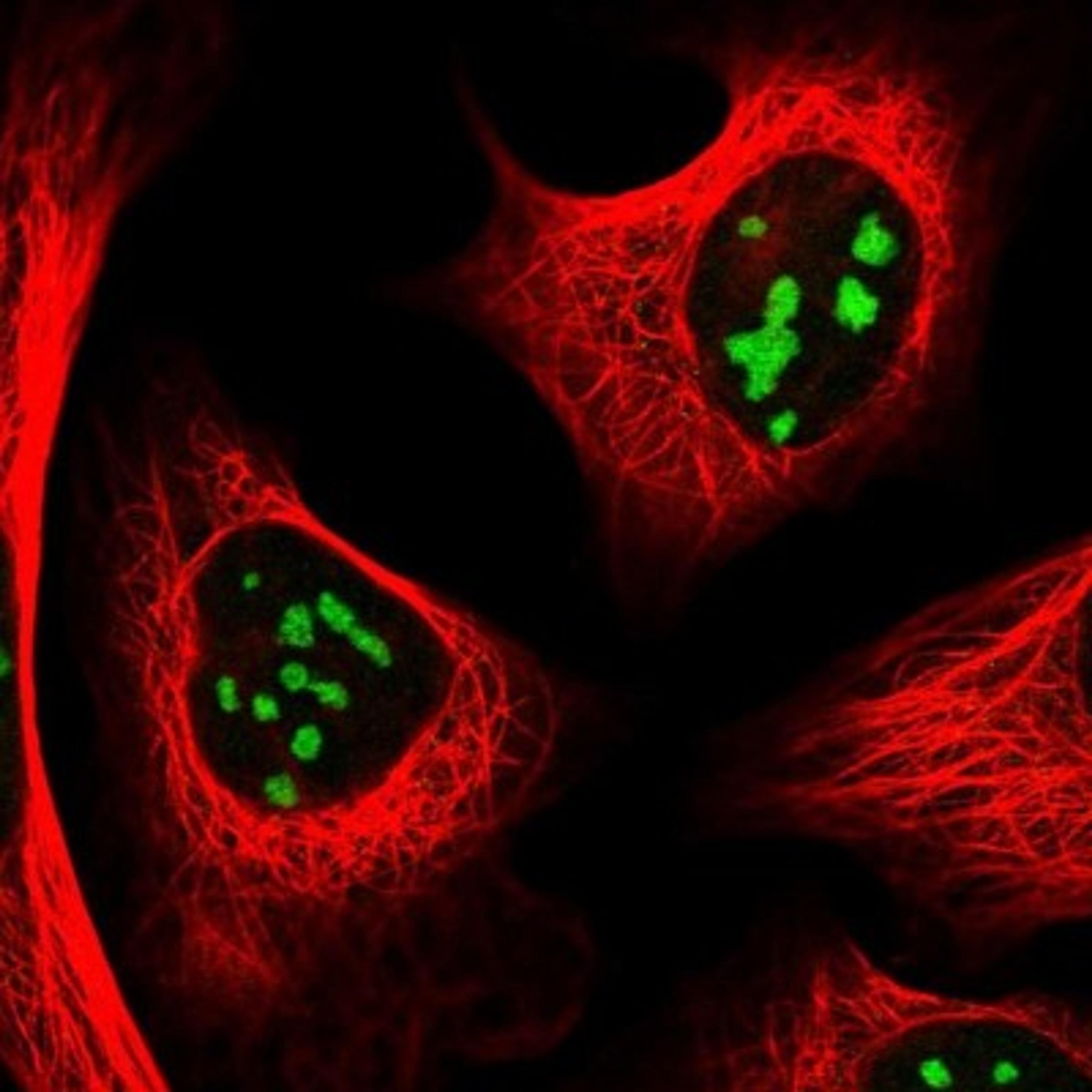 Immunofluorescence: RRS1 Antibody [NBP2-30725] - Immunofluorescent staining of human cell line U-2 OS shows positivity in nucleoli.