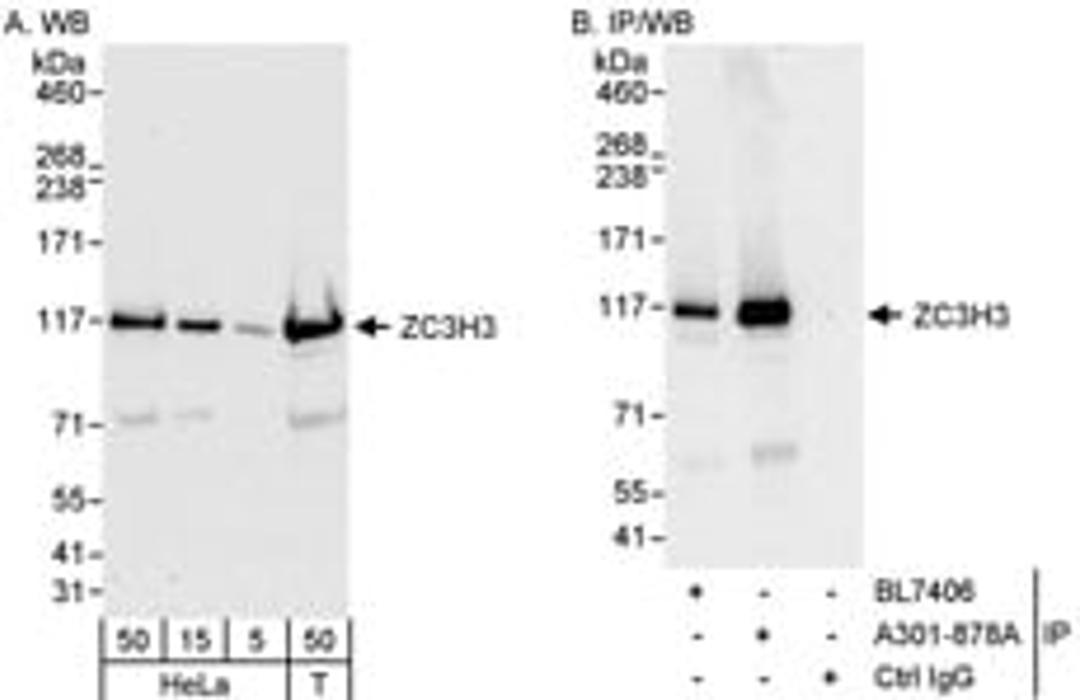 Detection of human ZC3H3 by western blot and immunoprecipitation.