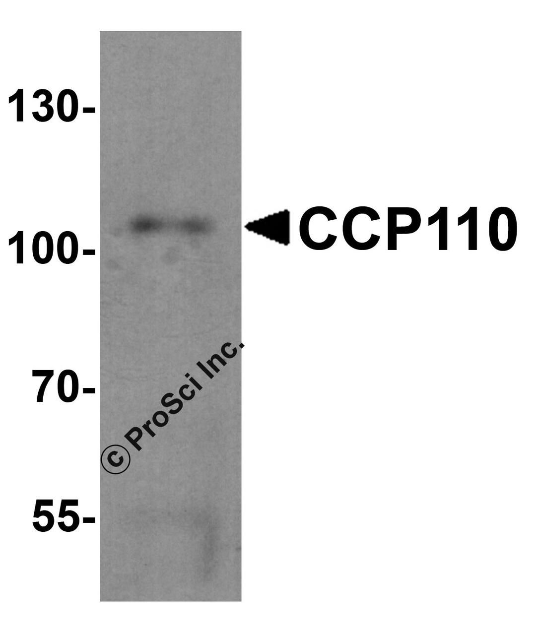 Western blot analysis of CCP110 in human colon tissue lysate with CCP110 antibody at 1 &#956;g/mL.