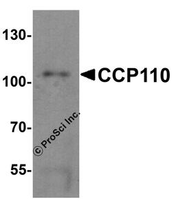 Western blot analysis of CCP110 in human colon tissue lysate with CCP110 antibody at 1 μg/mL.