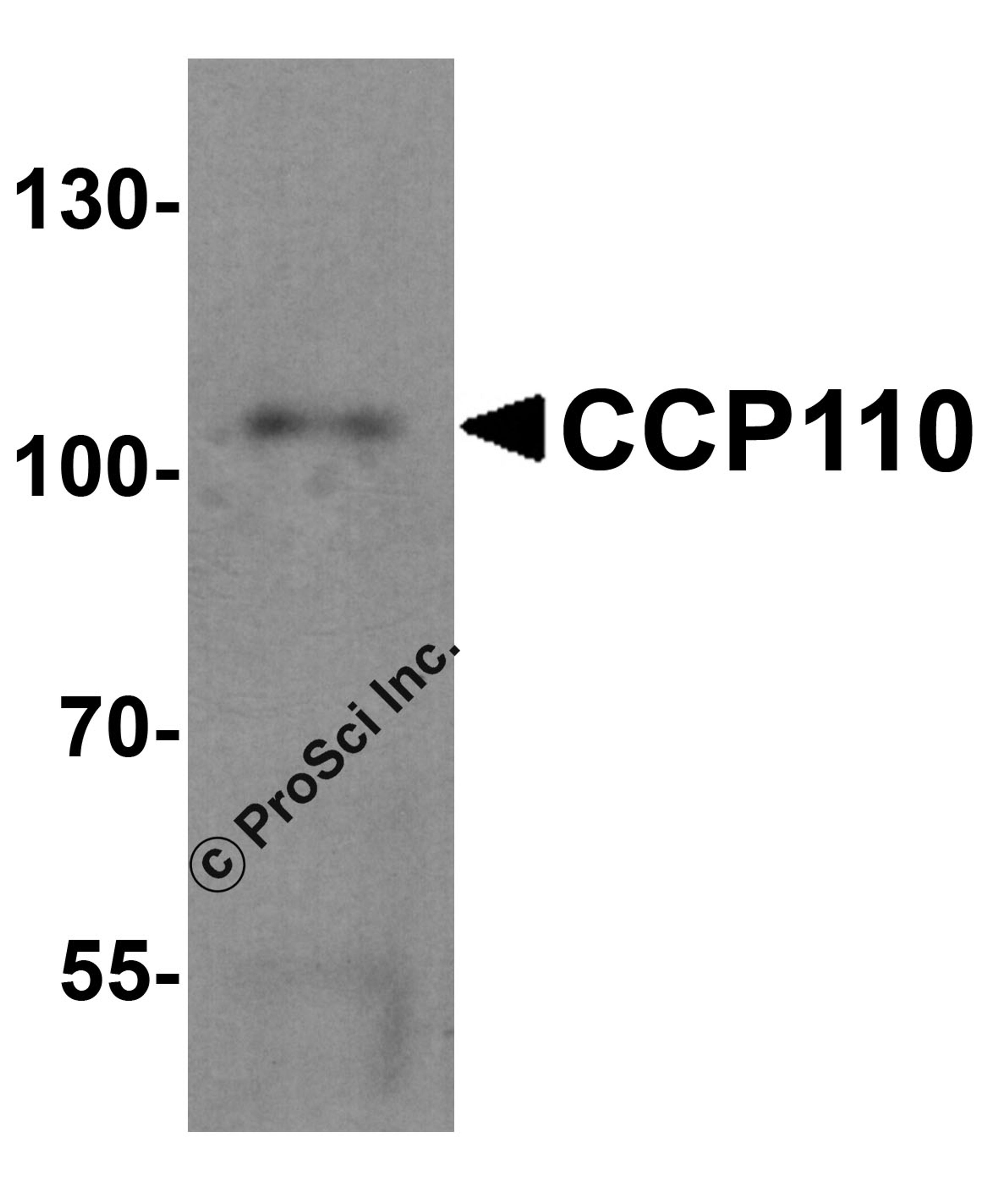 Western blot analysis of CCP110 in human colon tissue lysate with CCP110 antibody at 1 μg/mL.
