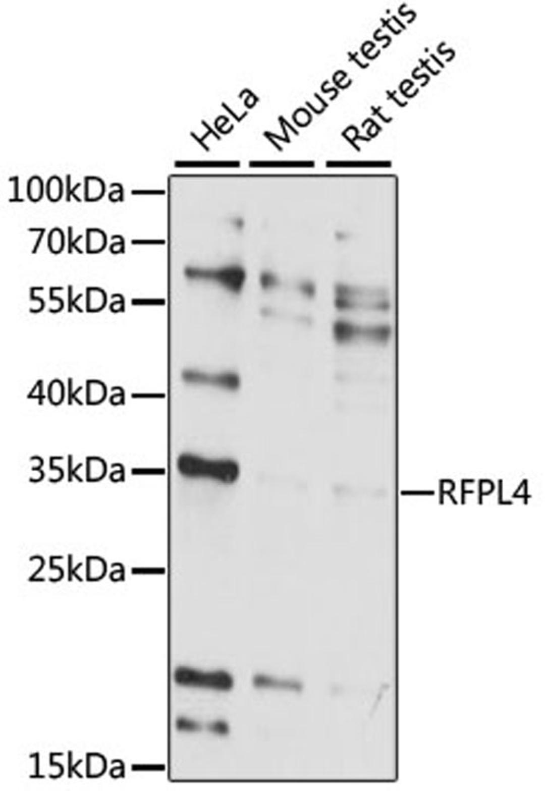 Western blot - RFPL4 antibody (A15981)