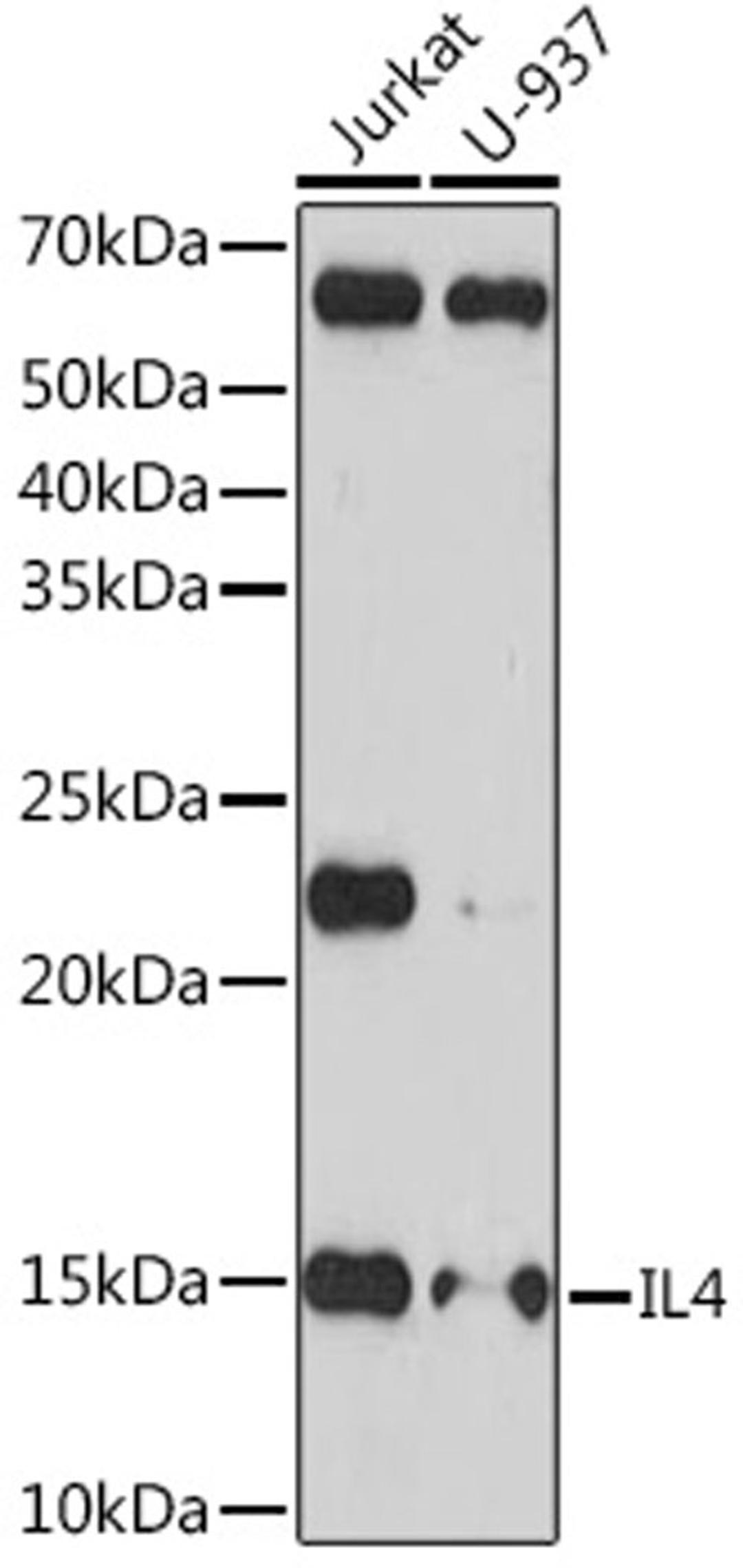 Western blot - IL4 Rabbit mAb (A4988)