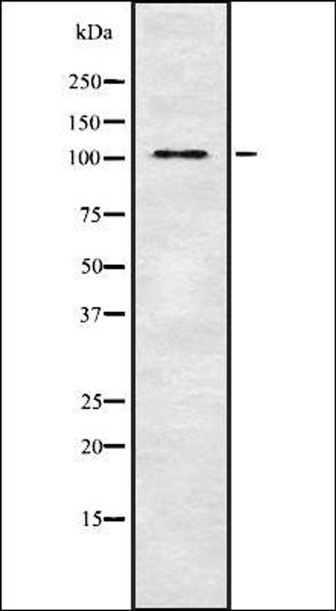 Western blot analysis of HeLa whole cell lysates using THRAP3 antibody