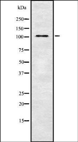 Western blot analysis of HeLa whole cell lysates using THRAP3 antibody