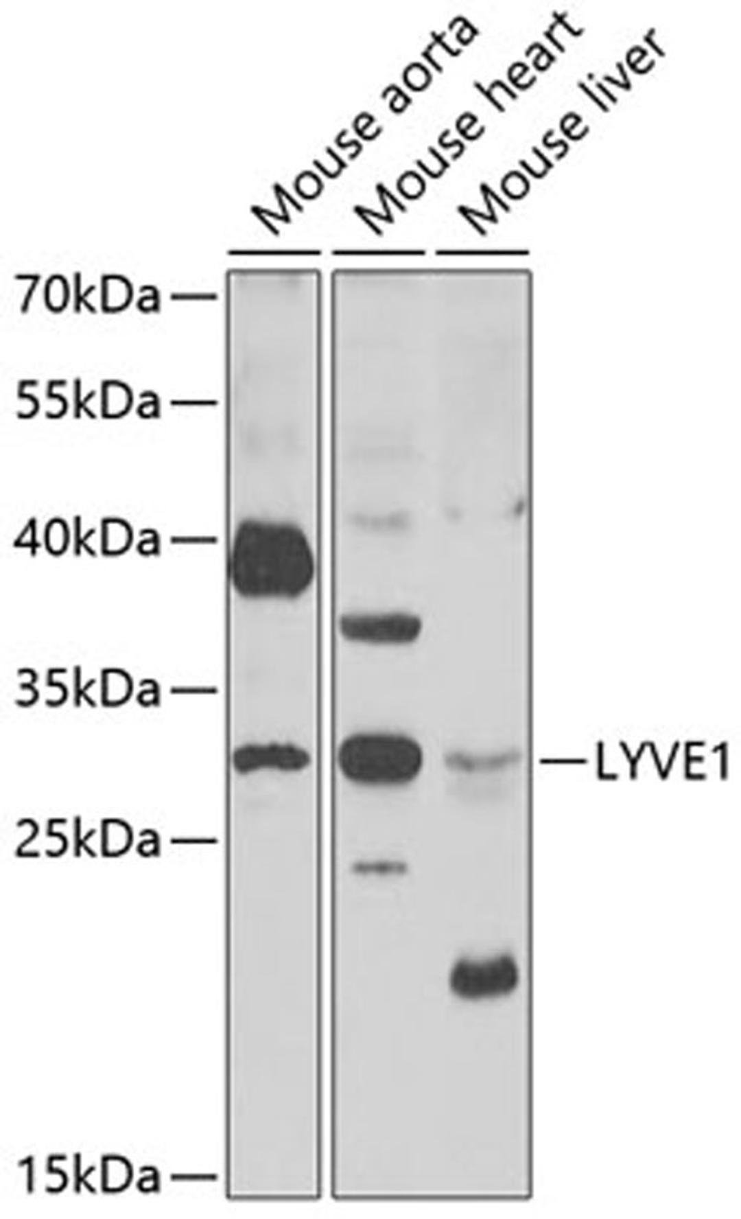 Western blot - LYVE1 antibody (A6452)