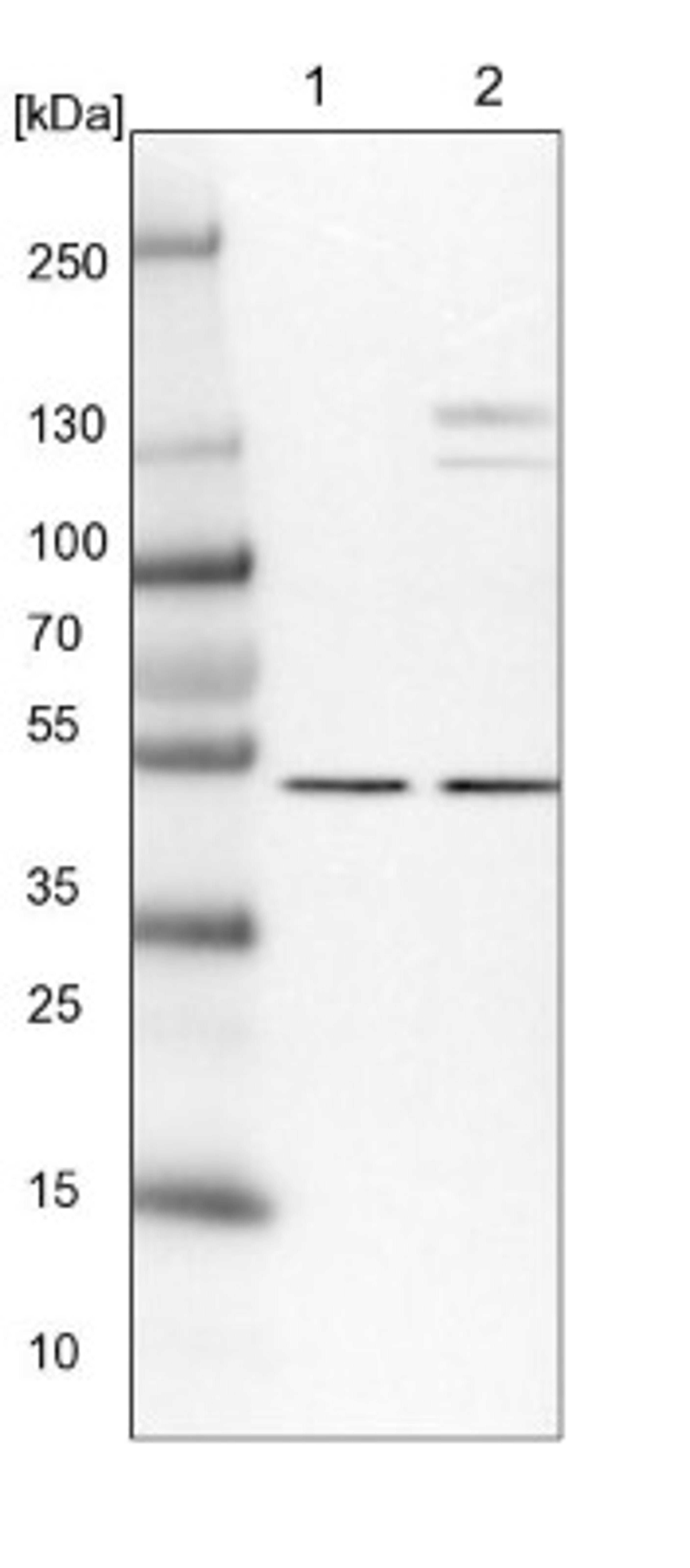 Western Blot: Aspartyl Aminopeptidase Antibody [NBP1-91684] - Lane 1: NIH-3T3 cell lysate (Mouse embryonic fibroblast cells)<br/>Lane 2: NBT-II cell lysate (Rat Wistar bladder tumour cells)