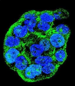 Confocal immunofluorescent analysis of WiDr cell using WTIP antibody 