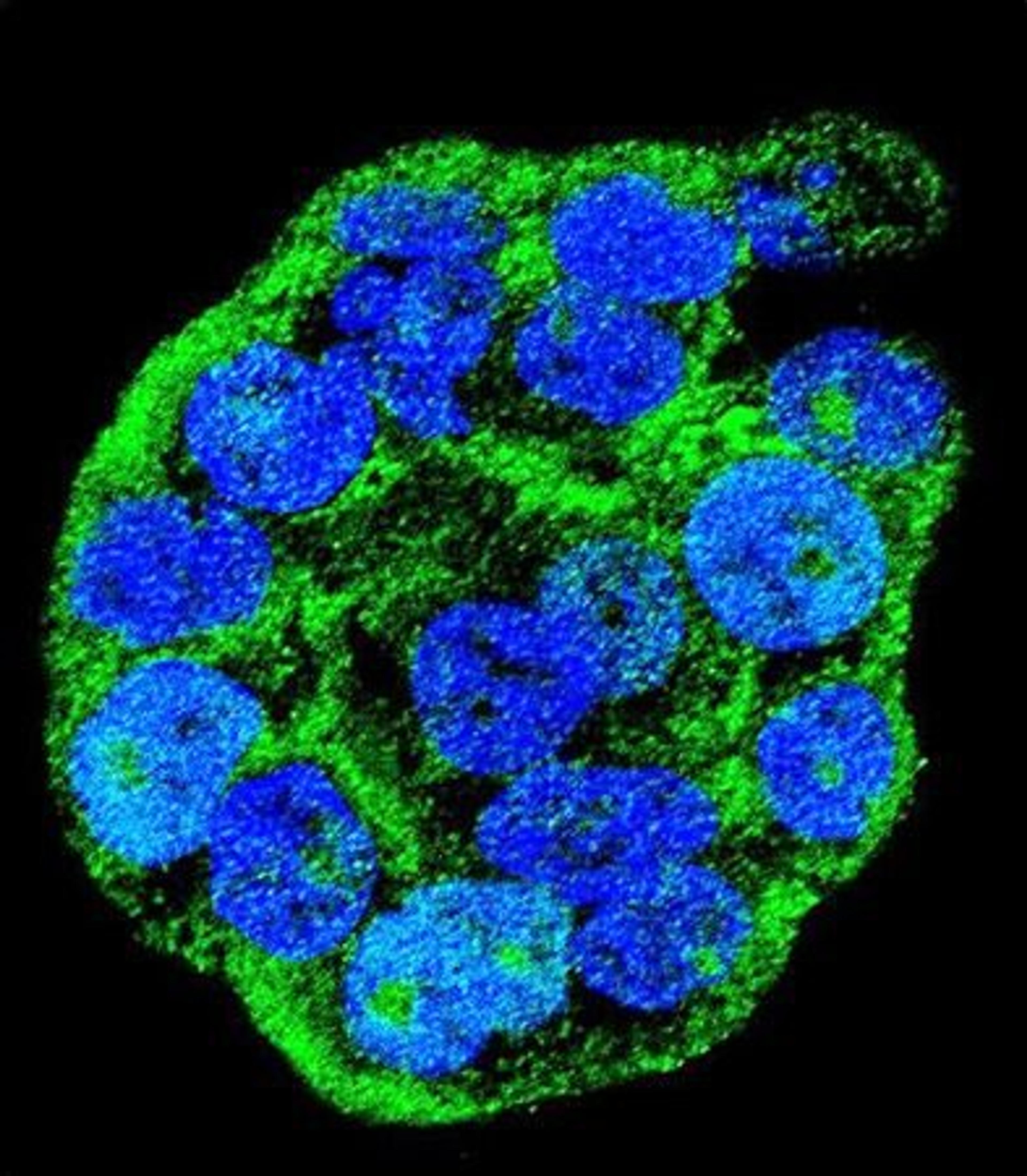 Confocal immunofluorescent analysis of WiDr cell using WTIP antibody 