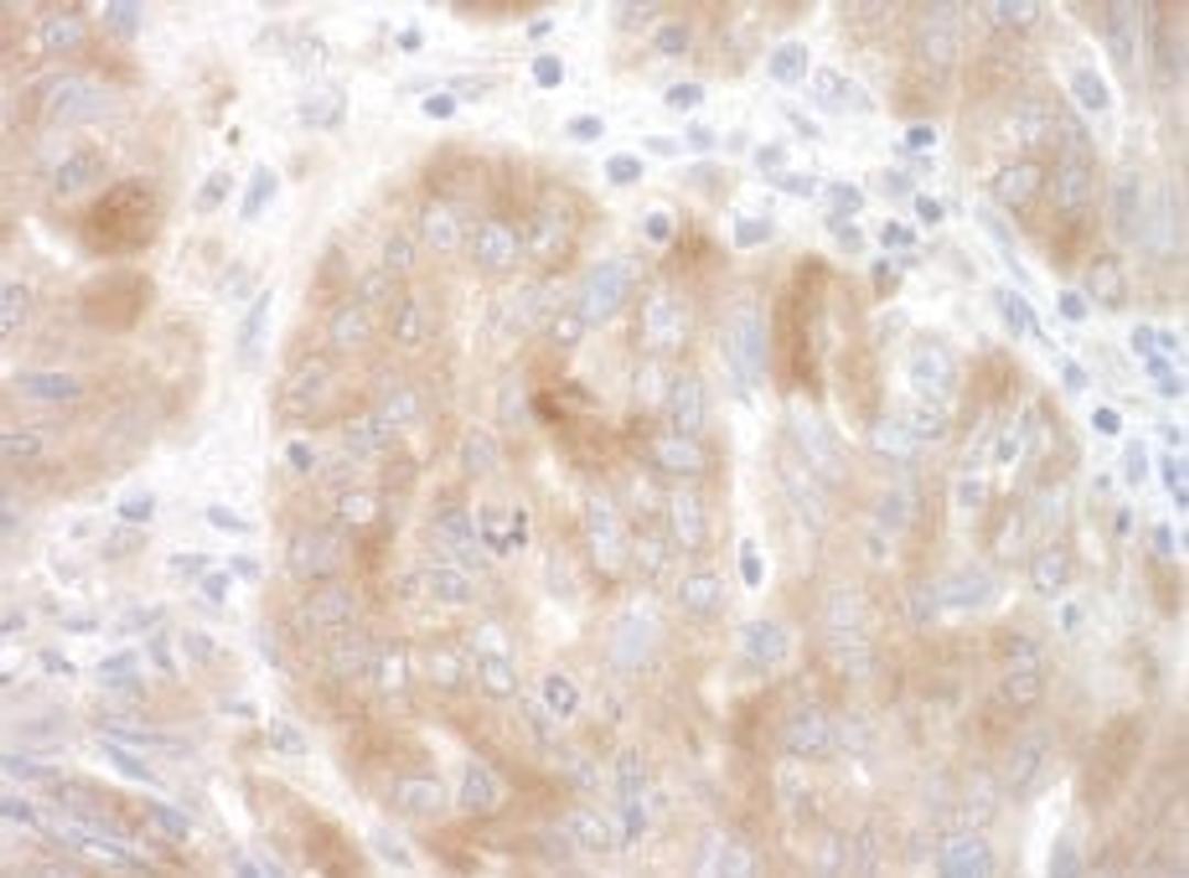 Detection of human SRPK2 by immunohistochemistry.