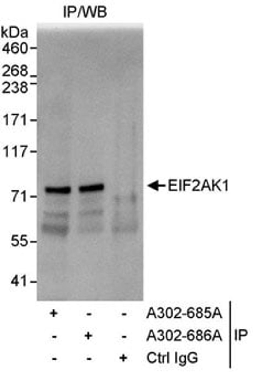 Detection of human EIF2AK1 by western blot of immunoprecipitates.