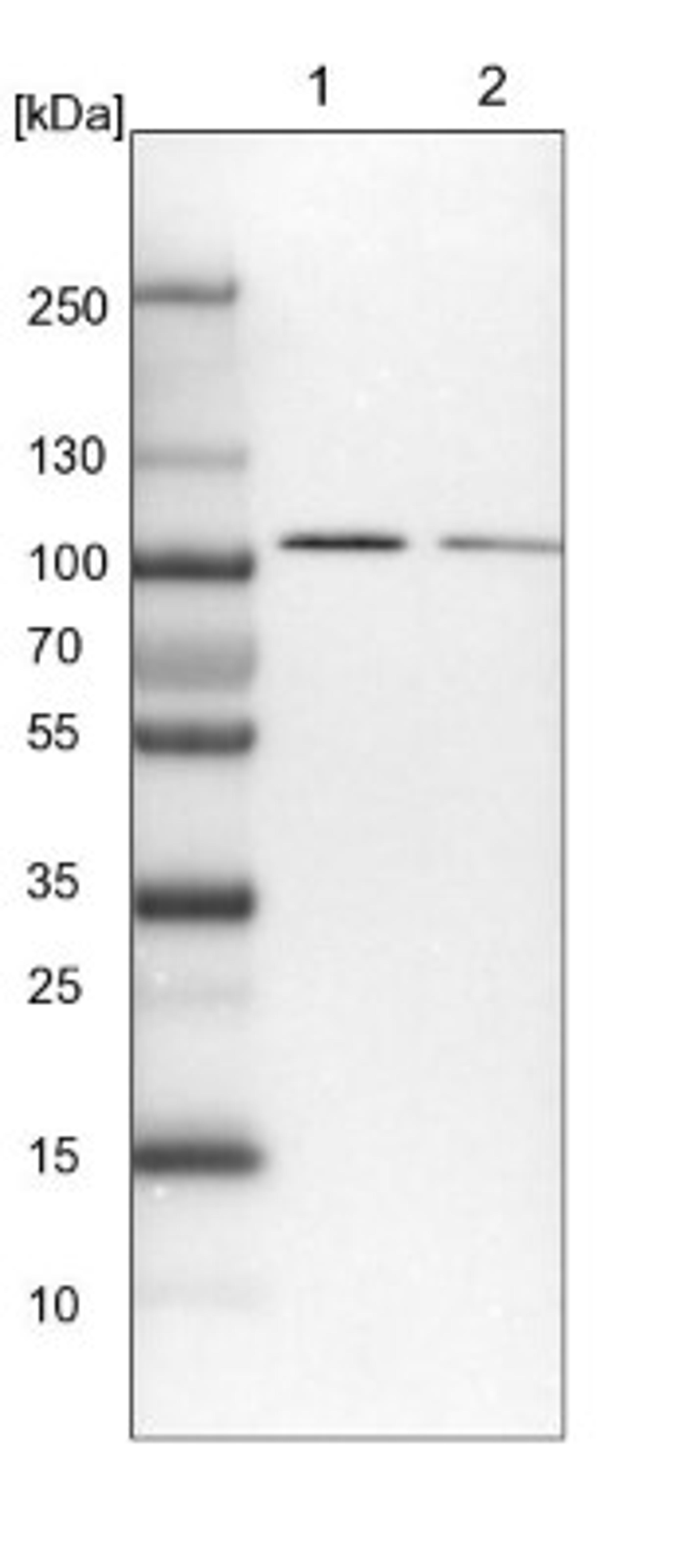 Western Blot: COPG Antibody [NBP1-85514] - Lane 1: NIH-3T3 cell lysate (Mouse embryonic fibroblast cells)<br/>Lane 2: NBT-II cell lysate (Rat Wistar bladder tumour cells)