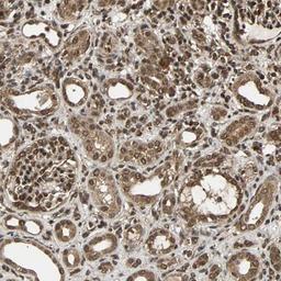 Immunohistochemistry-Paraffin: USP42 Antibody [NBP1-83715] - Staining of human kidney shows strong nuclear cytoplasmic positivity in cells in tubules and cells in glomeruli.