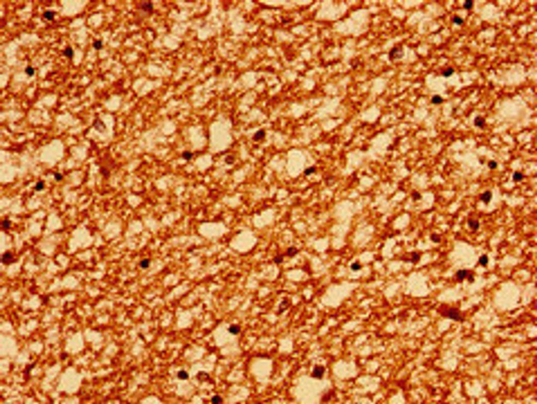 Immunohistochemistry of paraffin-embedded human brain tissue using CSB-PA019068YA01HU at dilution of 1:100