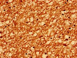 Immunohistochemistry of paraffin-embedded human brain tissue using CSB-PA019068YA01HU at dilution of 1:100