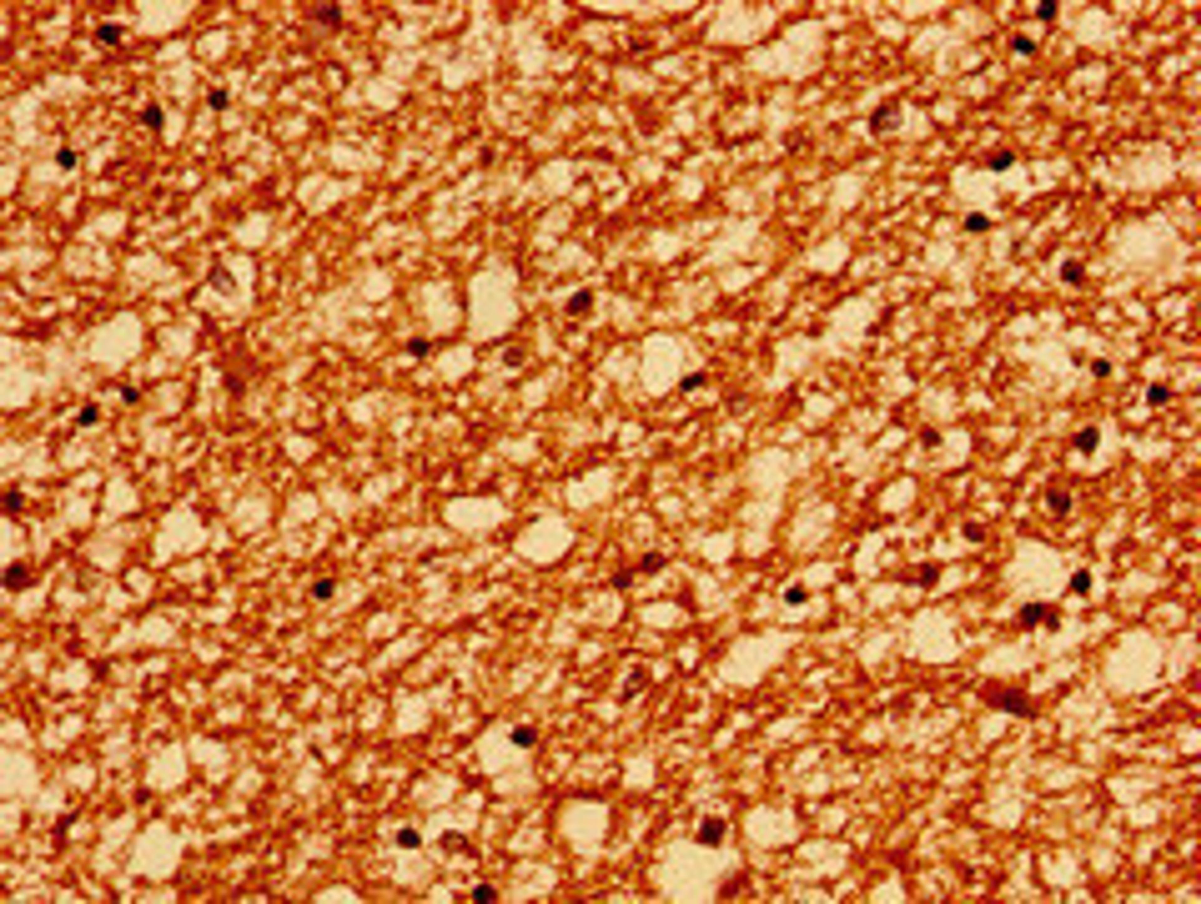 Immunohistochemistry of paraffin-embedded human brain tissue using CSB-PA019068YA01HU at dilution of 1:100