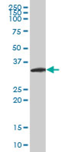 Western Blot analysis of NEUROGENIN 2 expression in H9c2(2-1)