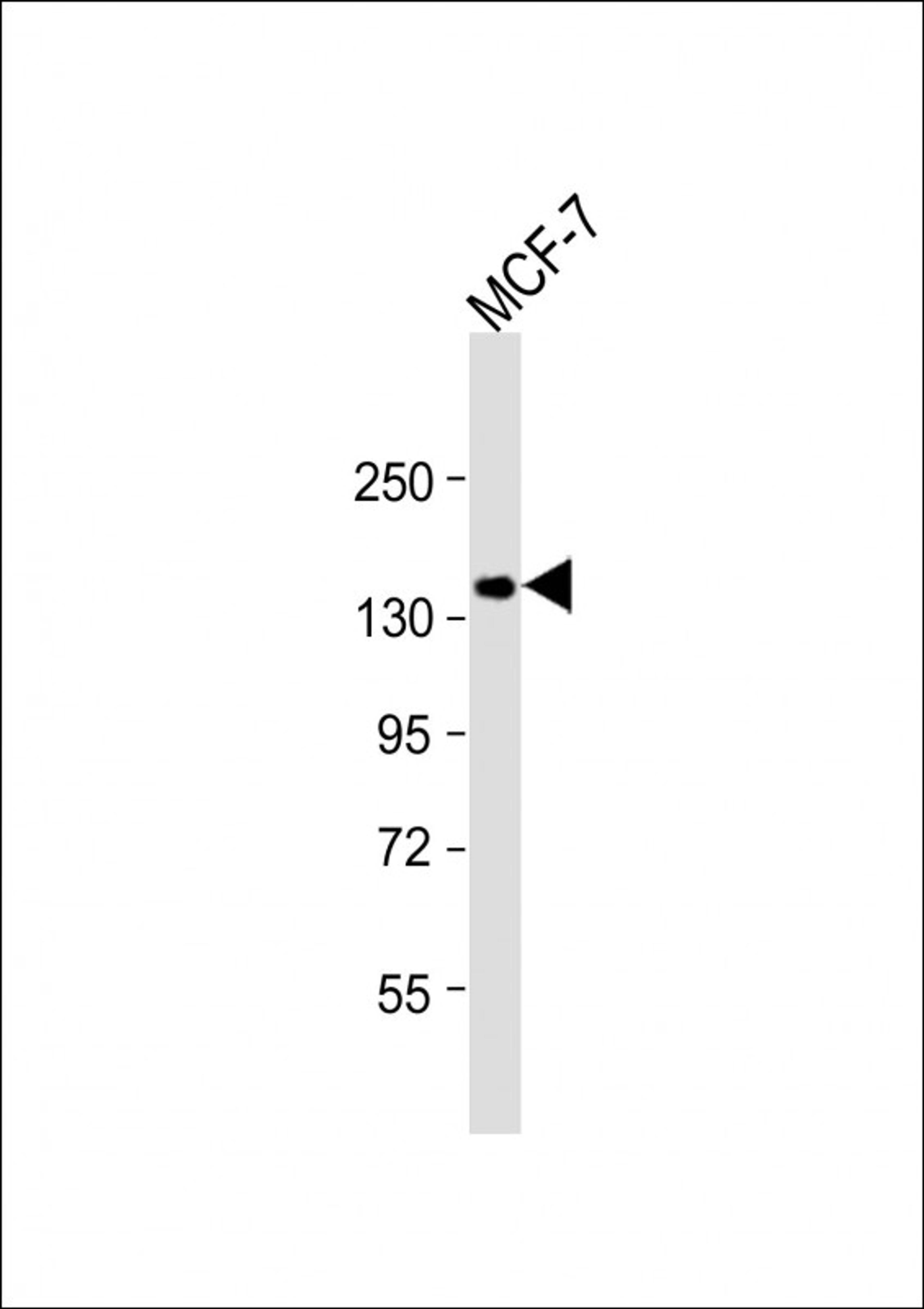 Western Blot at 1:1000 dilution + MCF-7 whole cell lysate Lysates/proteins at 20 ug per lane.