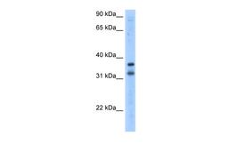 Antibody used in WB on Transfected 293T at 2.5 ug/ml.